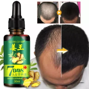 7 Days Hair Growth Germinal Serum Oil Natural Hair Treatment Effective Fast Growth Hair Care 30ML