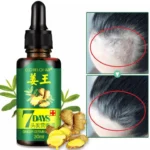 7 Days spray Hair Growth Germinal Serum Oil Natural Hair Treatment Effective Fast Growth Hair Care 30ML