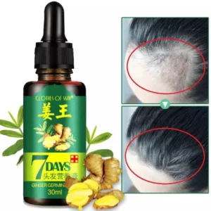 7 Days spray Hair Growth Germinal Serum Oil Natural Hair Treatment Effective Fast Growth Hair Care 30ML