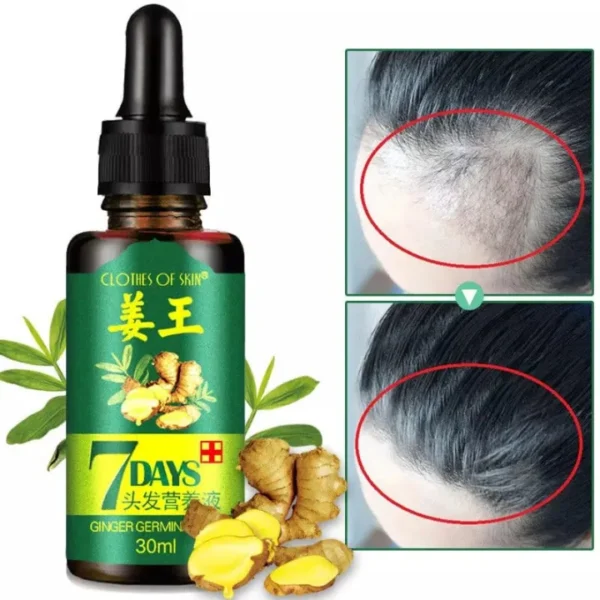 7 Days spray Hair Growth Germinal Serum Oil Natural Hair Treatment Effective Fast Growth Hair Care 30ML