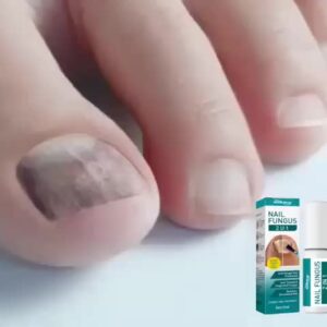 Fast Nail Fungal Treatments Nail Repair Essences Serum Care Treatments Foot Nail Fungus Removal Gel Paronychia Onychomycosis